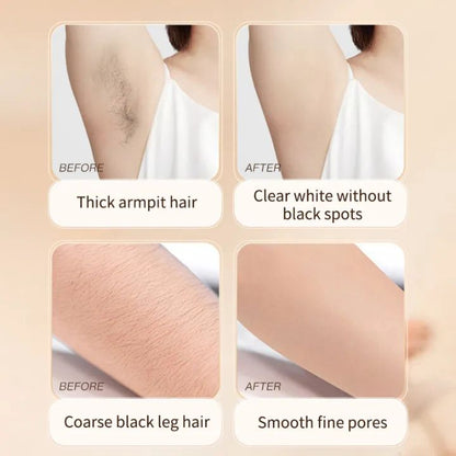 Hair Removal and Suppression Smooth Skin 250ML (Pack Of 2)